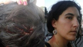 Lear: hospitalizaron a Nathalia González Seligra, secretaria de DD. HH. del Suteba La Matanza